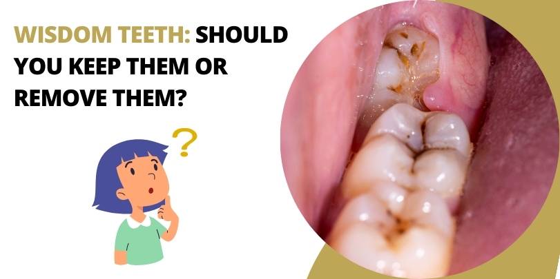 Wisdom Teeth: Should You Keep Them or Remove Them?