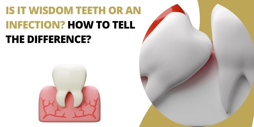 Is It Wisdom Teeth or an Infection? How to tell the difference?