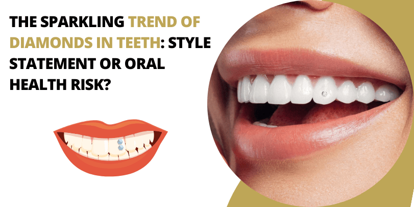 The Sparkling Trend of Diamonds in Teeth Style Statement or Oral Health Risk